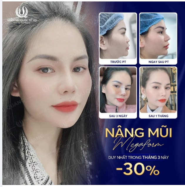 Bây giờ ra đường không cần makeup em cũng thấy đẹp nữa ​​​​​​​ Bạn k.h chia sẻ.