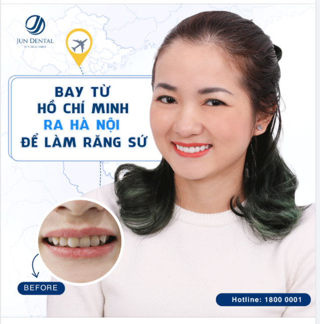 BAY TỪ HỒ CHÍ MINH RA HÀ NỘI ĐỂ LÀM RĂNG SỨ