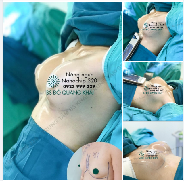 BỘ NGỰC ĐẸP VÀ TỰ NHIÊN MỀM MẠI - AI AI CŨNG THÍCH!