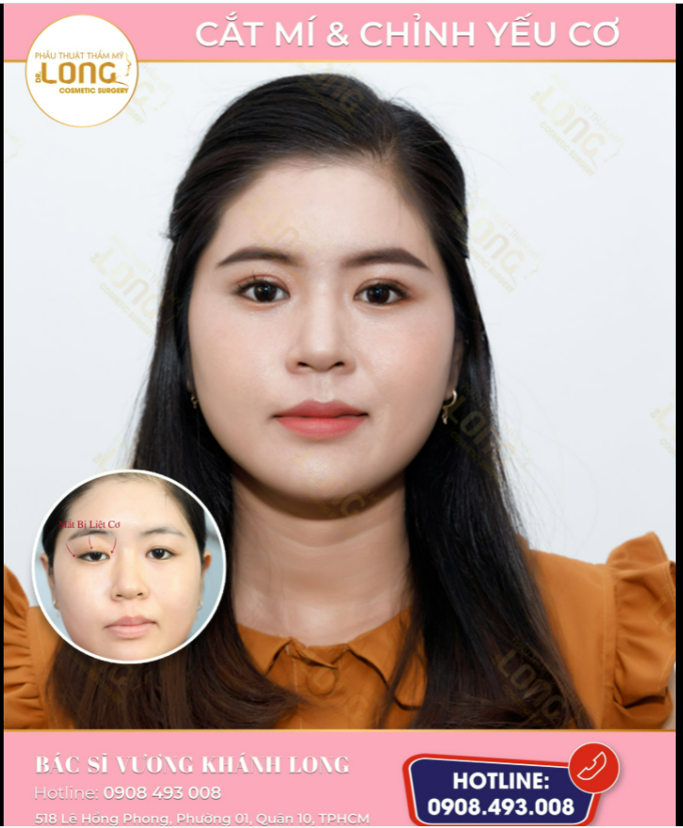 CA NÀO KHÓ ĐỂ ĐÓ BÁC SĨ LONG LO, KHÁCH YÊN TÂM NHA!
