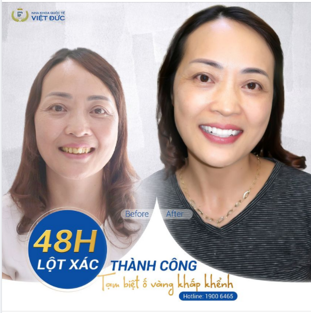 CẢM ƠN CÁC BÁC SĨ VÌ ĐÃ GIÚP MÌNH CÓ ĐƯỢC NỤ CƯỜI TỰ TIN