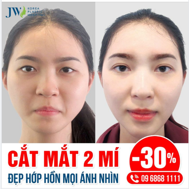 CẮT MẮT 2 MÍ ĐẸP HỚP HỒN MỌI ÁNH NHÌN