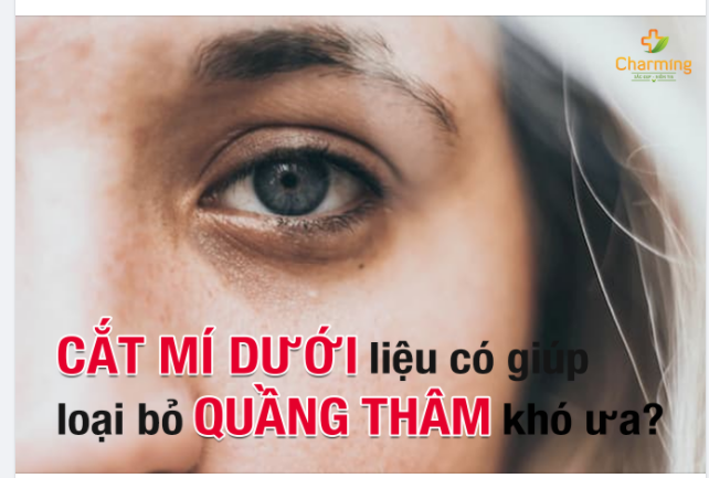 CẮT MÍ DƯỚI LIỆU CÓ GIÚP LOẠI BỎ QUẦNG THÂM KHÓ ƯA