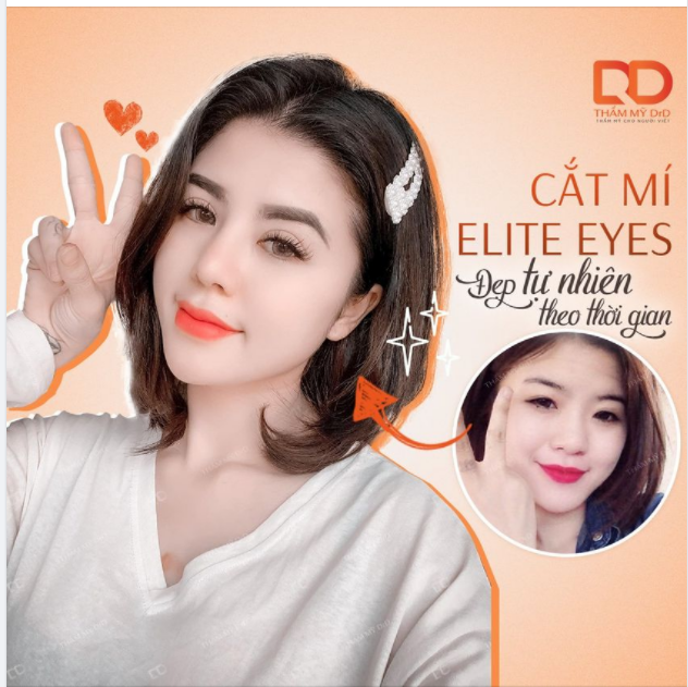 Cắt mí Elite Eyes - Đẹp tự nhiên theo thời gian.