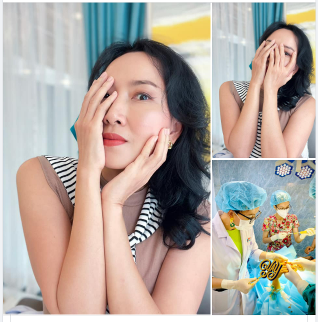 CẤY MỠ BÀN TAY TAY ĐẸP, MỀM MẠI THANH THOÁT
