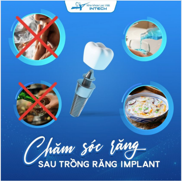 CHĂM SÓC RĂNG SAU KHI TRỒNG RĂNG IMPLANT