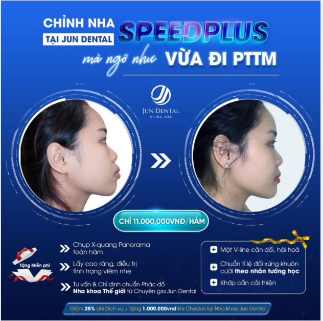 Chỉnh Nha sau 20 tháng mà ngỡ vừa đi PTTM về chuyện thật như đùa là chuyện có thật như cơm bữa tại Jun Dental