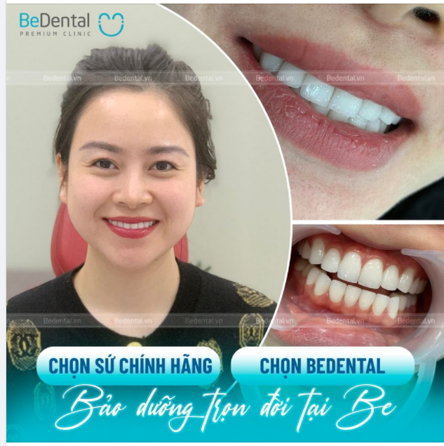 Chọn Bedental Chọn răng sứ chính hãng
