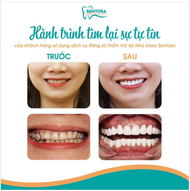 CHƯA BAO GIỜ LÀ QUÁ MUỘN ĐỂ TÌM LẠI VẺ ĐẸP CHO CHÍNH MÌNH