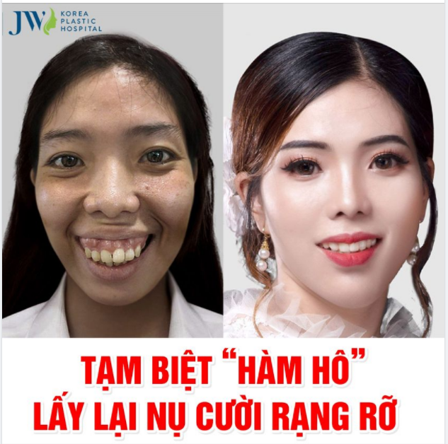 CÔ GÁI NHỎ KHIẾM KHUYẾT “ GÁNH TRÊN VAI NỖI LO” CẦU CỨU