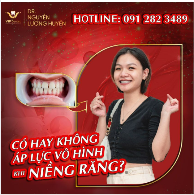 CÓ HAY KHÔNG NHỮNG ÁP LỰC VÔ HÌNH KHI NIỀNG RĂNG