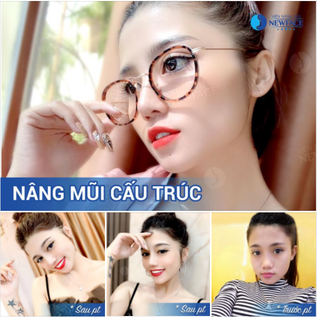 Có một ngày trời xanh mây trắng Cô ấy cười như nắng Tôi đứng ngắm Ngẩn ngơ.