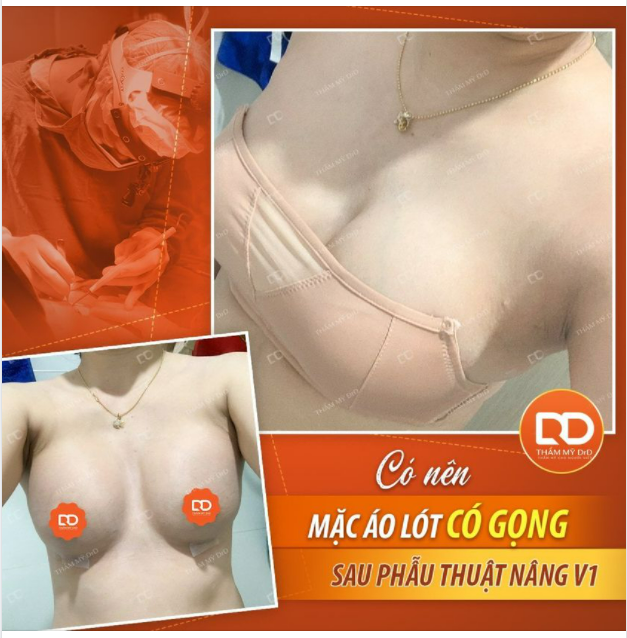 CÓ NÊN MẶC ÁO LÓT CÓ GỌNG SAU NÂNG V1