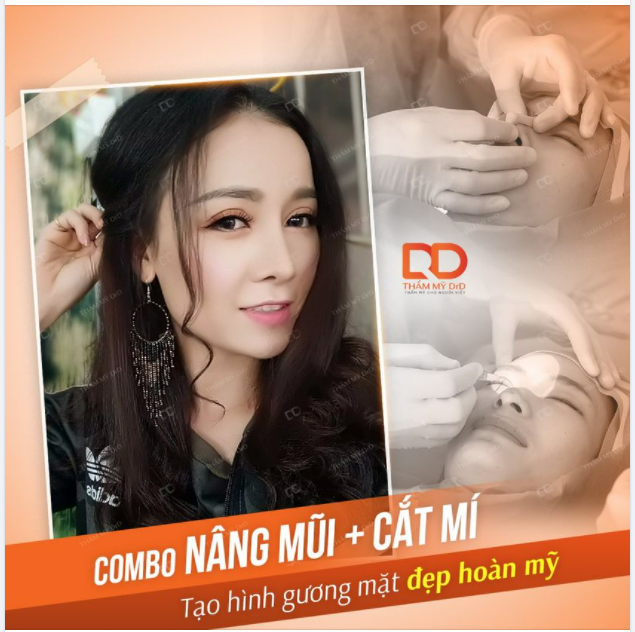 Combo nâng mũi + cắt mí - Tạo hình gương mặt đẹp hoàn mỹ.