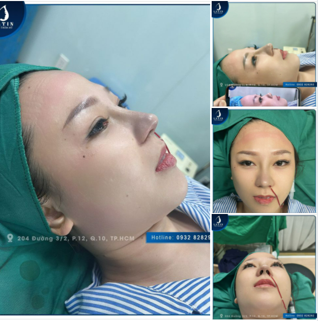 Cư dân mạng đang dày công phân tích về chi phí chơi golf cho người mới bắt đầu, nghe đồn kinh phí lên tới vài chục triệu đồng.