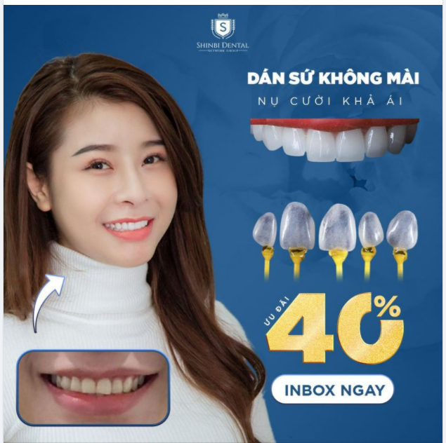 DÁN SỨ KHÔNG MÀI TẠI SHINBI - KIẾN TẠO NỤ CƯỜI KHẢ ÁI
