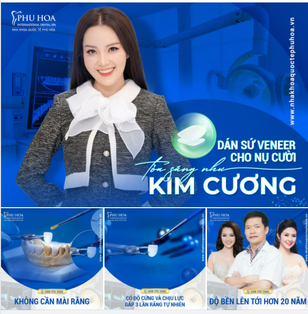 DÁN SỨ VENEER CHO NỤ CƯỜI TỎA SÁNG NHƯ KIM CƯƠNG