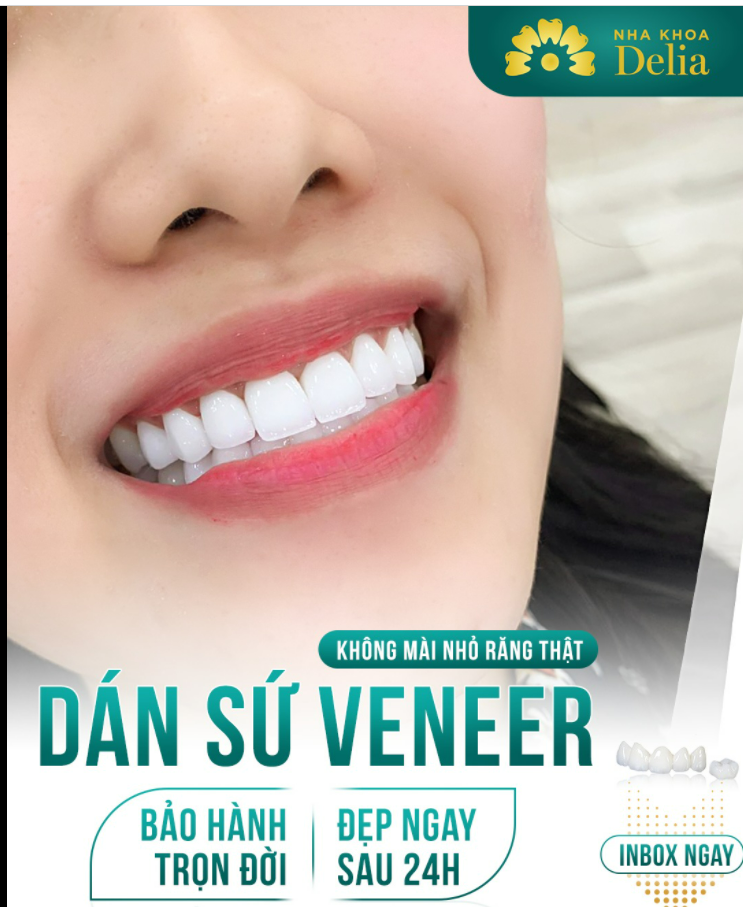 Dán sứ Veneer SIÊU MỎNG Mài cực ít Bảo tồn răng gốc tối đa