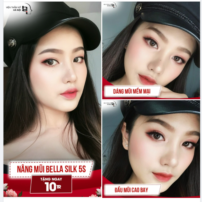 DÁNG MŨI MỀM MẠI - ĐẦU MŨI CAO BAY