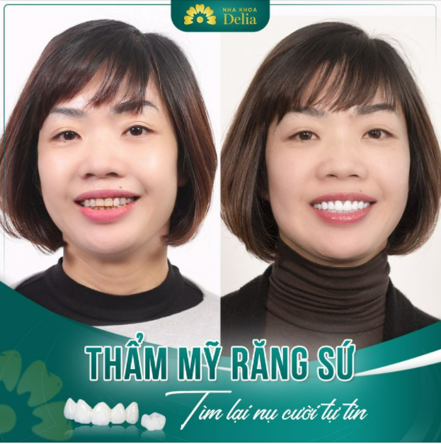 Đầu tư nụ cười - Tìm lại tự tin