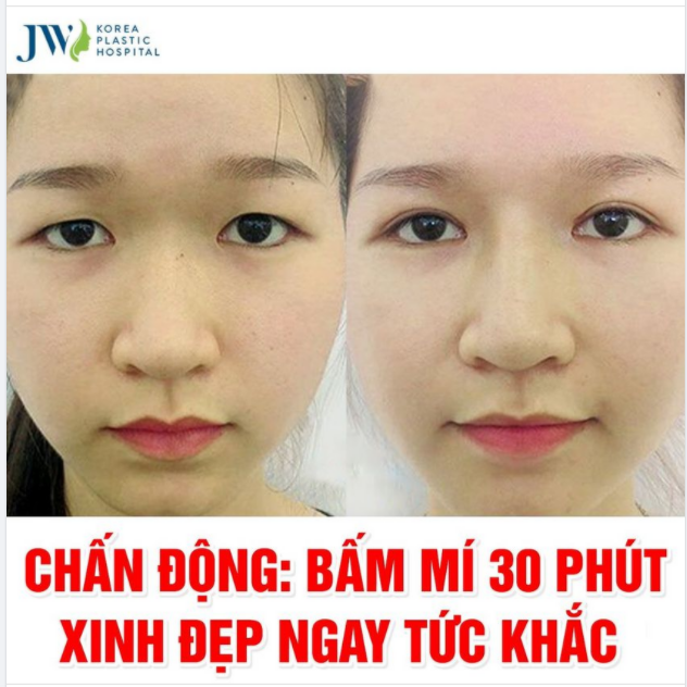 ĐẾN BẤM MÍ HÀN QUỐC NGAY - NHANH TAY THĂNG HẠNG NHAN SẮC