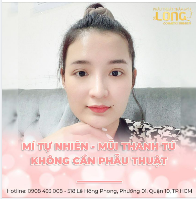 ĐẸP NGAY CẢ KHI KHÔNG PHẪU THUẬT LÀ NHƯ THẾ NÀO