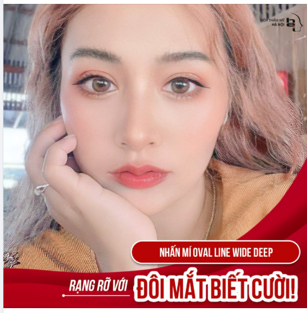 ĐẸP RẠNG RỠ VỚI ĐÔI MẮT BIẾT CƯỜI!