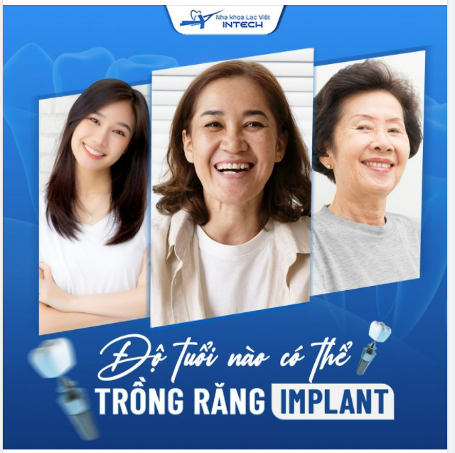 ĐỘ TUỔI NÀO CÓ THỂ TRỒNG RĂNG IMPLANT