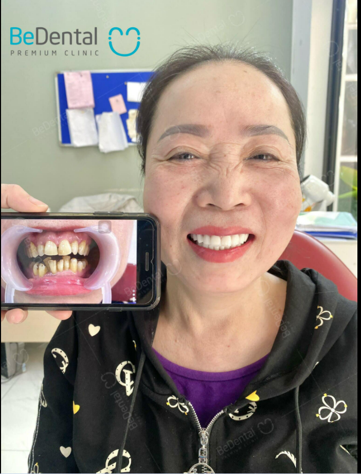 Đưa cô KH U60 về thanh xuân