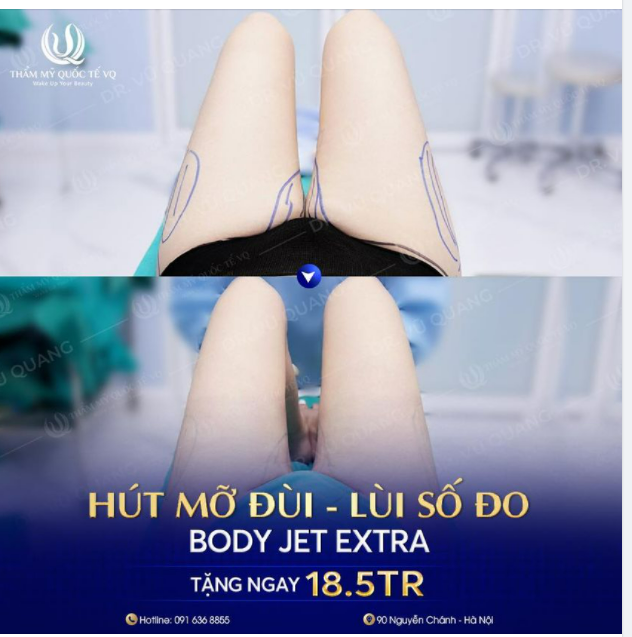 Đùi to - Chân xấu Hãy tới VQ