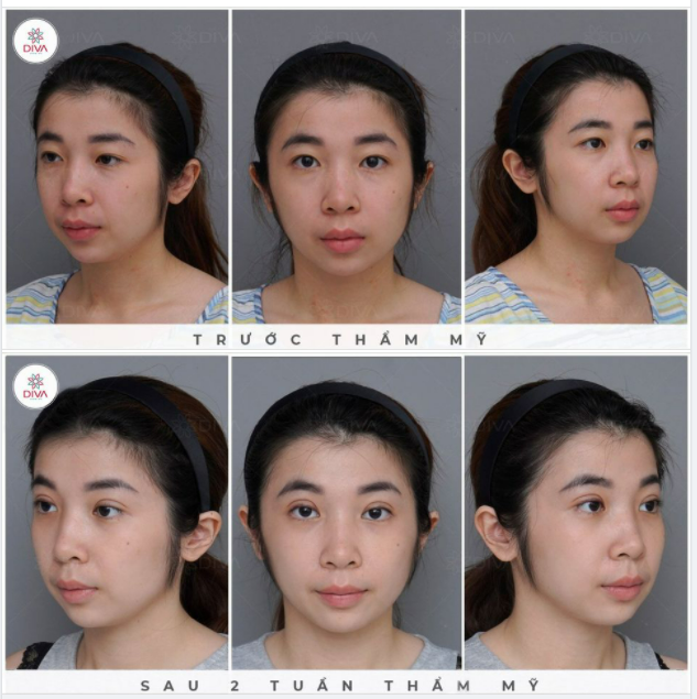 ĐỪNG LÀM “ANH EM NƯƠNG TỰA” ANH EM THƯƠNG NHAU DẮT NHAU ĐẾN DIVA LÀM ĐẸP NÈ!
