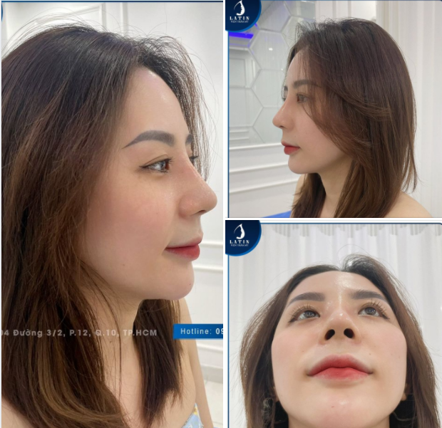 Đường đời thì trăm ngả Còn em thì thả nhẹ mũi xinh ở đây ạ