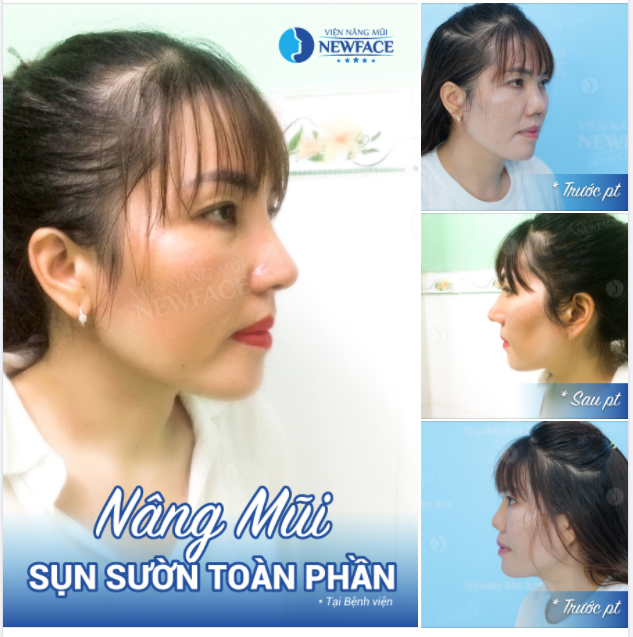“EM GIỐNG NHƯ ĐƯỢC HỒI SINH LẦN NỮA”