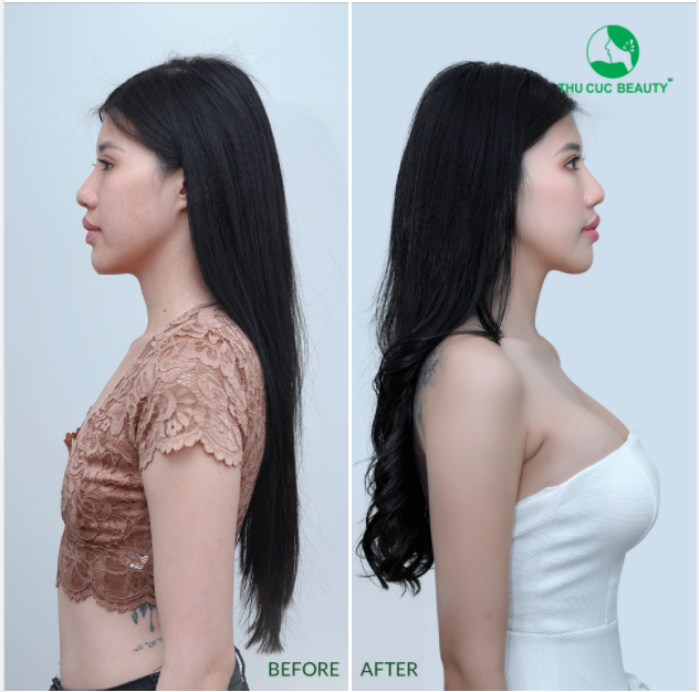 ÉP DẦU ÉP M.Ỡ SAO NỠ...... ÉP V1 VÀO NHỮNG CHIẾC ÁO ĐỘN ĐẦY GỌNG SẮT