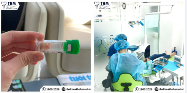 Ét Ô Ét  1 pha xử lý răng khôn không đau tại Nha khoa Thế Hệ Mới