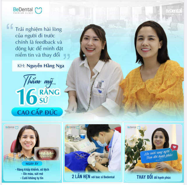 Ét Ô Ét !!! Đã tìm thấy Tấm vé về thanh xuân của chị khách hàng Bedental