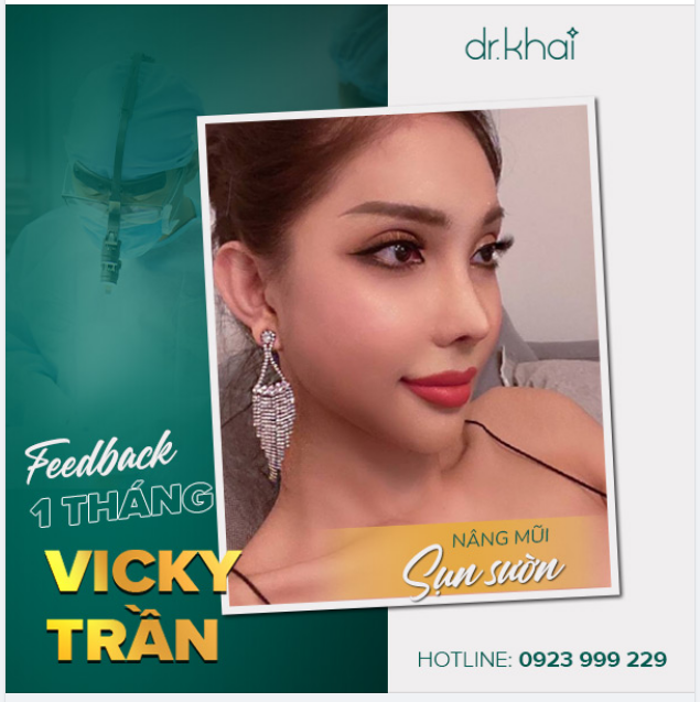 FEEDBACK NÂNG MŨI SỤN SƯỜN TỪ Vicky trần