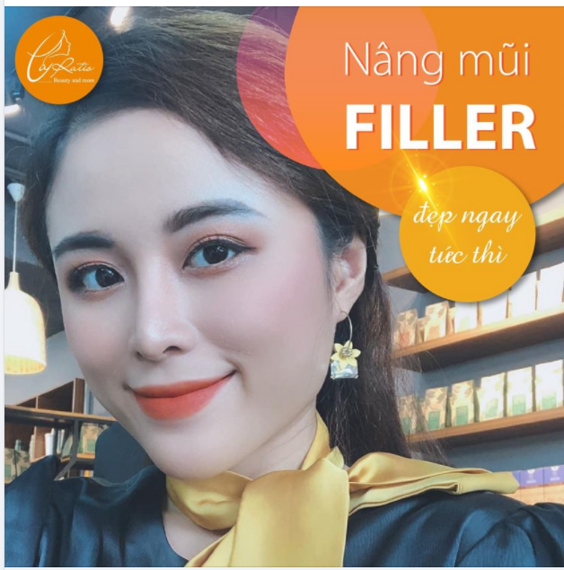 FILLER MŨI KHÔNG PHẪU THUẬT ĐẸP CHUẨN NHƯ NGỌC NỮ