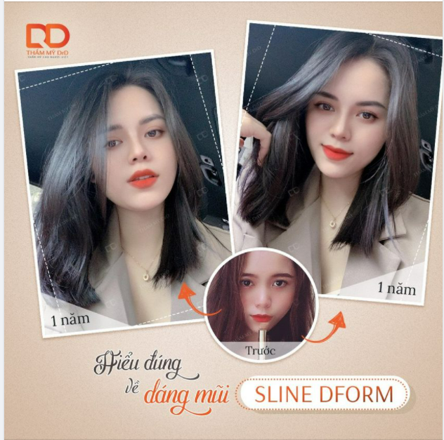 Gặp tình trạng nào - Chọn dáng mũi nấy