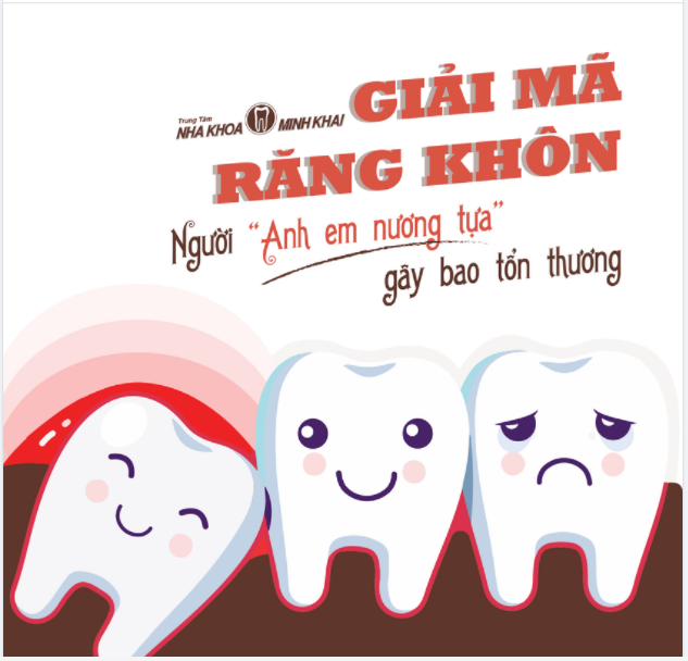 GIẢI MÃ RĂNG KHÔN – NGƯỜI “ANH EM NƯƠNG TỰA” GÂY BAO TỔN THƯƠNG