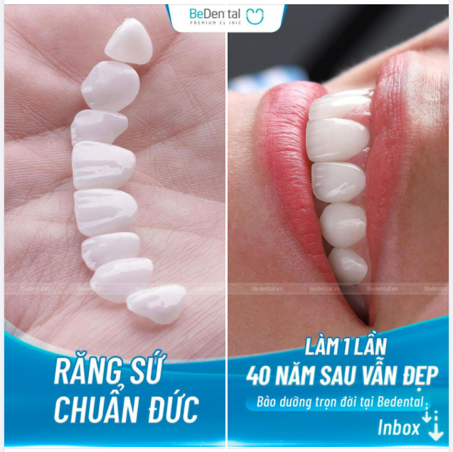 GIẢM NGAY 10.000.000đ khi làm 16 răng sứ Đức