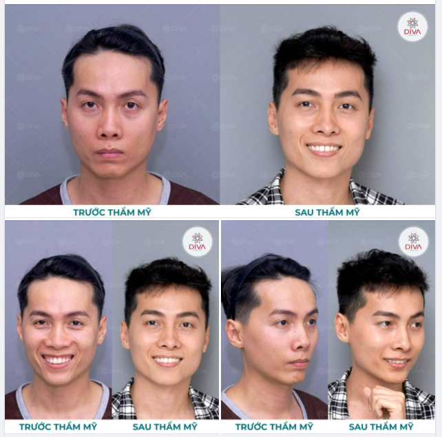 HÔ BIẾN GƯƠNG MẶC HỐC HÁC, GIÀ NUA THÀNH GƯƠNG MẶT THẦN THÁI TRẺ TRUNG, THU HÚT
