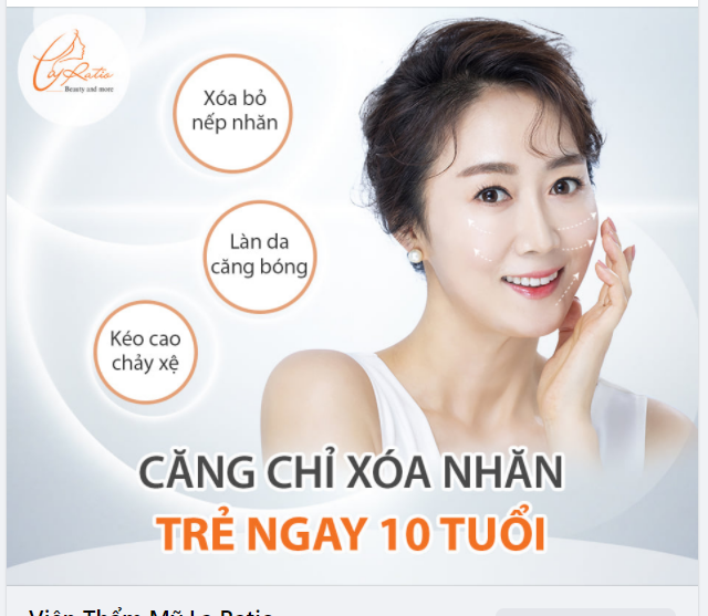 HÔ BIẾN NHĂN XỆ - Làm đầy hõm sâu bằng phương pháp căng chỉ Collagen