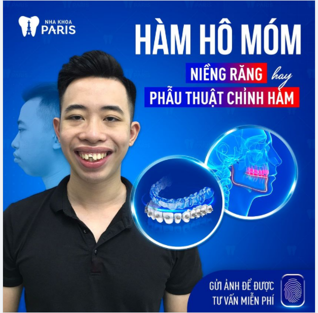 Hô - Móm cần làm gì để khắc phục triệt để