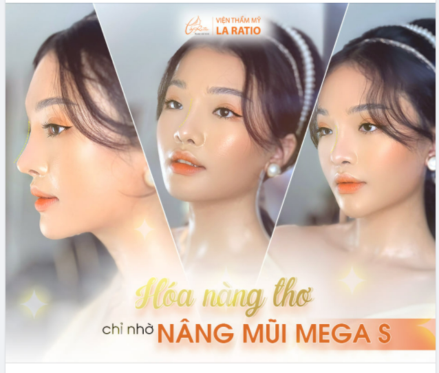 HÓA NÀNG THƠ SAU 1 TUẦN NÂNG MŨI MEGA S