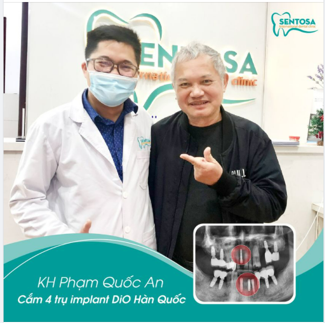 IMPLANT - TRỒNG MỘT LẦN ​​​​​​​ DÙNG MỘT ĐỜI.