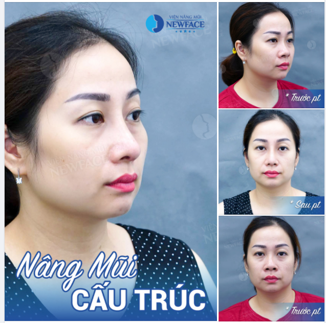 Kể từ giờ em phải thật là xinh Rạng rỡ yêu đời dù mưa hay nắng