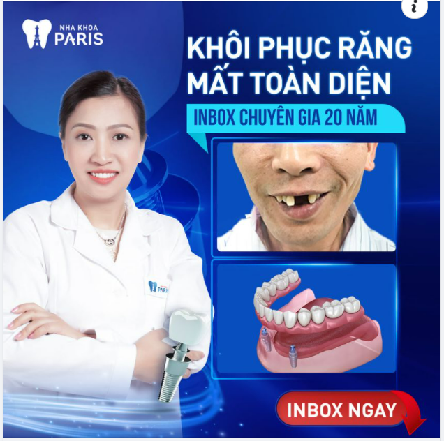 KHÔI PHỤC RĂNG MẤT CÙNG CHUYÊN GIA 20 NĂM KINH NGHIỆM