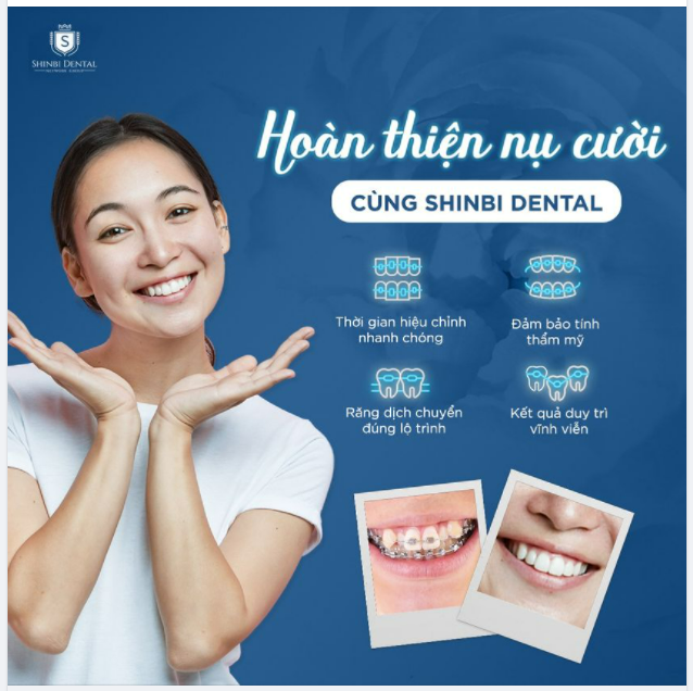 Không có lý do gì để chúng ta không nỗ lực và cố gắng hoàn thiện nụ cười của mình trở nên khỏe hơn, đẹp hơn phải không
