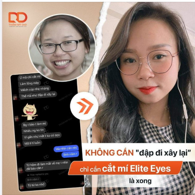 Không phải do DrD phóng đại lên mà tự khách hàng cũng nhận thấy rằng Chỉ cần Cắt mí rồi make up nhẹ nhàng thế mà như đập đi xây lại.